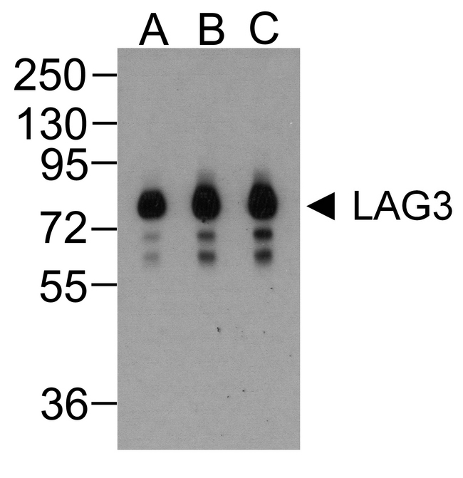 LAG3 Antibody - Western blot analysis of LAG-3 in over expressing HEK293 cells using LAG-3 antibody at (A) 0.25 (B) 0.5 and (C) 1 ug/ml.