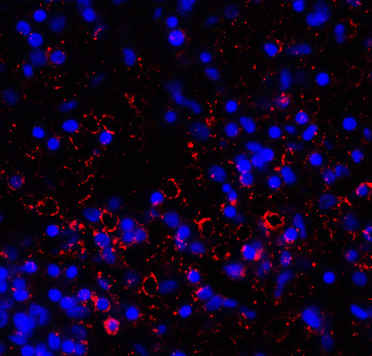 LAG3 Antibody - Immunofluorescence of LAG-3 in over human spleen tissue using LAG-3 Antibody at 10 ug/ml. Red: LAG3 Antibody [2G8] Blue: DAPI staining