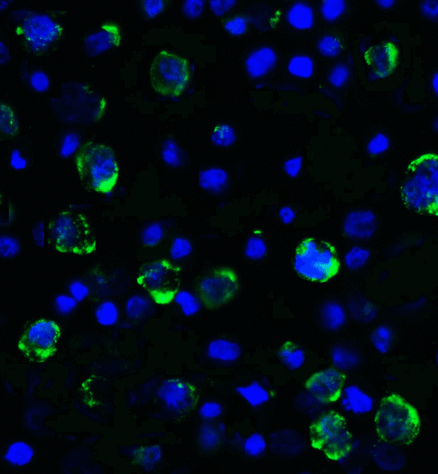 LAG3 Antibody - Immunofluorescence of LAG-3 in over expressing HEK293 cells using LAG-3 Antibody at 2 ug/ml. Green: LAG3 Antibody [2G8] Blue: DAPI staining
