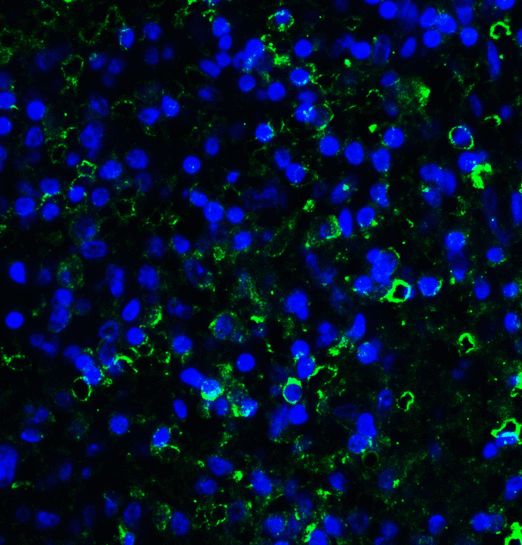 LAG3 Antibody - Immunofluorescence of LAG-3 in over human spleen tissue using LAG-3 Antibody at 10 ug/ml. Green: LAG3 Antibody [5F11] Blue: DAPI staining