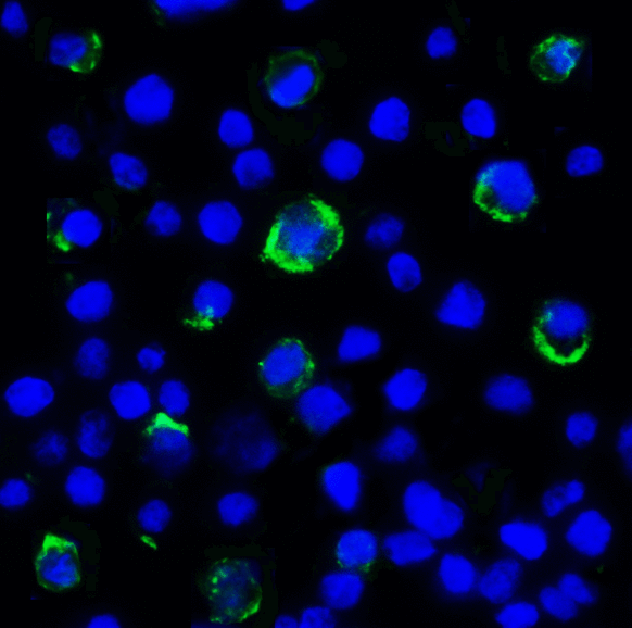 LAG3 Antibody - Immunofluorescence of LAG-3 in over expressing HEK293 cells using LAG-3 Antibody at 2 ug/ml. Green: LAG3 Antibody [5F11] Blue: DAPI staining
