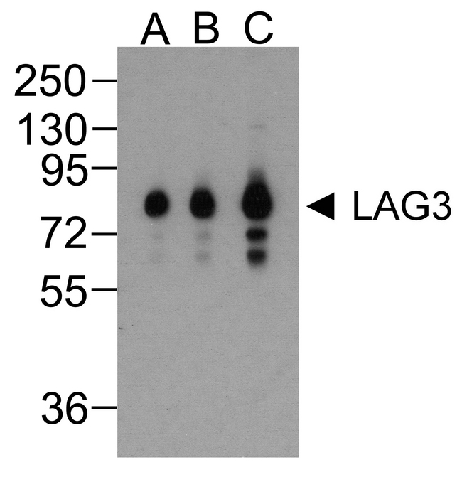 LAG3 Antibody - Western blot analysis of LAG-3 in over expressing HEK293 cells using LAG-3 antibody at (A) 0.25 (B) 0.5 and (C) 1 ug/ml.