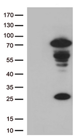 LAG3 Antibody - HEK293T cells were transfected with the pCMV6-ENTRY control. (Left lane) or pCMV6-ENTRY LAG3. (Right lane) cDNA for 48 hrs and lysed. Equivalent amounts of cell lysates. (5 ug per lane) were separated by SDS-PAGE and immunoblotted with anti-LAG3. (1:500)