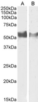 LAG3 Antibody - Goat anti-LAG3 / CD223 Antibody (1µg/ml) staining of Human Lymph Node (A) and (0.5ug/ml) Tonsil (B) lysate (35µg protein in RIPA buffer). Primary incubation was 1 hour. Detected by chemiluminescencence.