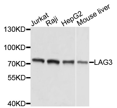 LAG3 Antibody - Western blot analysis of extracts of various cells.