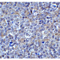 LAG3 Antibody - Immunohistochemistry of LAG3 in human tonsil tissue with LAG3 antibody at 5 µg/ml.