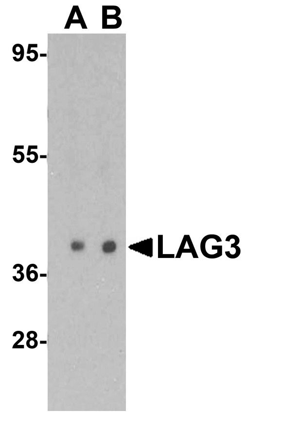 LAG3 Antibody - Western blot analysis of LAG3 in human liver tissue lysate with LAG3 antibody at (A) 1 and (B) 2 ug/mL