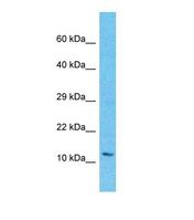 LAGE3 Antibody - Western blot of Human HeLa. LAGE3 antibody dilution 1.0 ug/ml.  This image was taken for the unconjugated form of this product. Other forms have not been tested.
