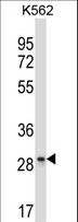 LAIR1 / CD305 Antibody - LAIR1 Antibody western blot of K562 cell line lysates (35 ug/lane). The LAIR1 antibody detected the LAIR1 protein (arrow).