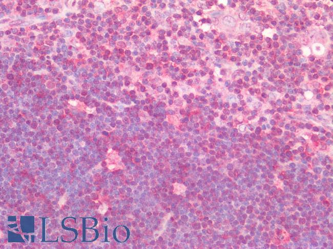 LAIR1 / CD305 Antibody - Human Thymus: Formalin-Fixed, Paraffin-Embedded (FFPE)