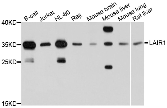 LAIR1 / CD305 Antibody - Western blot analysis of extracts of various cell lines, using LAIR1 antibody at 1:1000 dilution. The secondary antibody used was an HRP Goat Anti-Rabbit IgG (H+L) at 1:10000 dilution. Lysates were loaded 25ug per lane and 3% nonfat dry milk in TBST was used for blocking. An ECL Kit was used for detection and the exposure time was 15s.