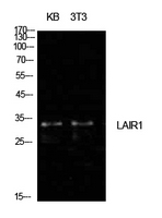 LAIR1 / CD305 Antibody - Western Blot analysis of extracts from KB, NIH-3T3 cells using LAIR1 Antibody.