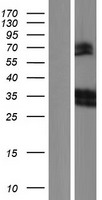 LAIR1 / CD305 Protein - Western validation with an anti-DDK antibody * L: Control HEK293 lysate R: Over-expression lysate