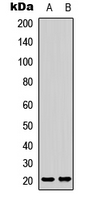 LAIR2 / CD306 Antibody - Western blot analysis of CD306 expression in MCF7 (A); rat kidney (B) whole cell lysates.