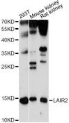LAIR2 / CD306 Antibody - Western blot analysis of extracts of various cell lines, using LAIR2 antibody at 1:1000 dilution. The secondary antibody used was an HRP Goat Anti-Rabbit IgG (H+L) at 1:10000 dilution. Lysates were loaded 25ug per lane and 3% nonfat dry milk in TBST was used for blocking. An ECL Kit was used for detection and the exposure time was 30s.