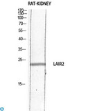 LAIR2 / CD306 Antibody - Western Blot (WB) analysis of specific cells using Antibody diluted at 1:1000.