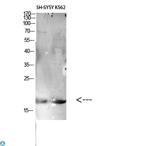 LAIR2 / CD306 Antibody - Western Blot (WB) analysis of Rat Kidney lysis using LAIR2 antibody.