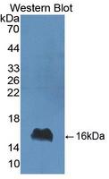LALBA / Alpha Lactalbumin Antibody - Western blot of LALBA / Alpha Lactalbumin antibody.