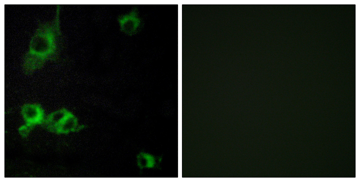 LAMA1 / Laminin Alpha 1 Antibody - Immunofluorescence analysis of COS7 cells, using LAMA1 Antibody. The picture on the right is blocked with the synthesized peptide.