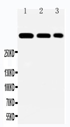 LAMA2 / Merosin Antibody - WB of LAMA2 / Merosin antibody. Lane 1: HELA Cell Lysate. Lane 2: A549 Cell Lysate. Lane 3: PANC Cell Lysate.