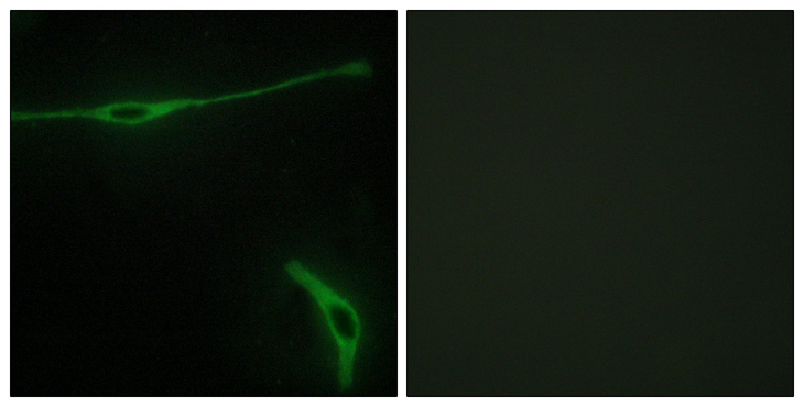 LAMA2 / Merosin Antibody - Immunofluorescence analysis of NIH/3T3 cells, using LAMA2 Antibody. The picture on the right is blocked with the synthesized peptide.