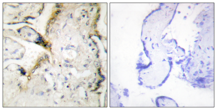 LAMA2 / Merosin Antibody - Immunohistochemistry analysis of paraffin-embedded human placenta tissue, using LAMA2 Antibody. The picture on the right is blocked with the synthesized peptide.