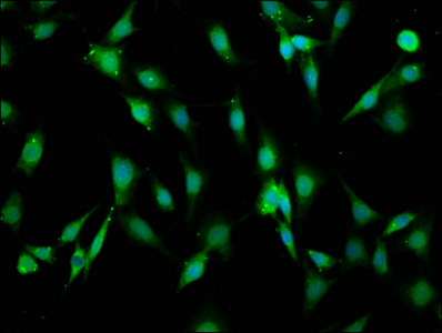 LAMA2 / Merosin Antibody - Immunofluorescence staining of NIH/3T3 cells at a dilution of 1:66, counter-stained with DAPI. The cells were fixed in 4% formaldehyde, permeabilized using 0.2% Triton X-100 and blocked in 10% normal Goat Serum. The cells were then incubated with the antibody overnight at 4 °C.The secondary antibody was Alexa Fluor 488-congugated AffiniPure Goat Anti-Rabbit IgG (H+L) .