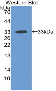 LAMA3 / Laminin Alpha 3 Antibody - Western blot of recombinant LAMA3 / Laminin Alpha 3.  This image was taken for the unconjugated form of this product. Other forms have not been tested.