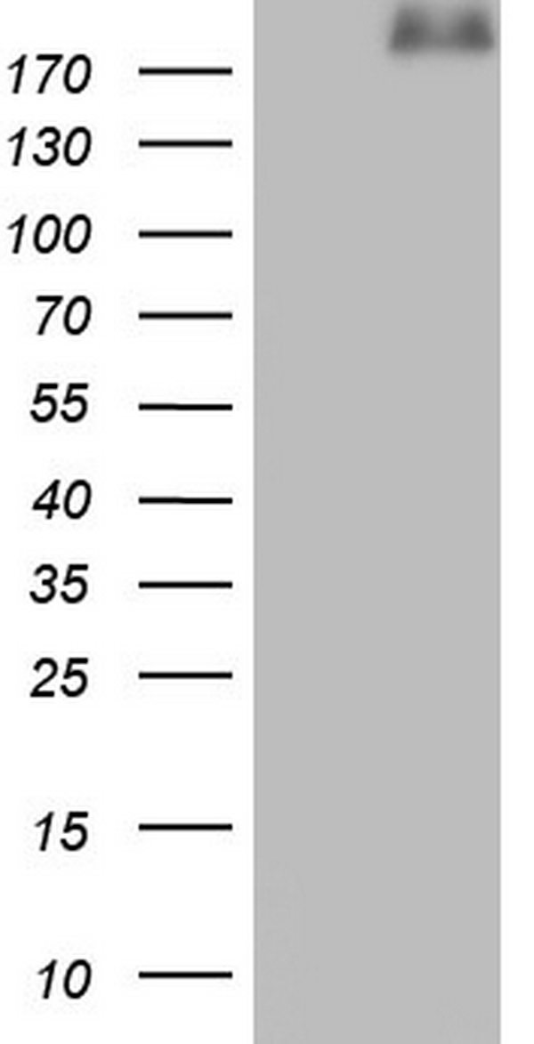 LAMA4 / Laminin Alpha 4 Antibody - HEK293T cells were transfected with the pCMV6-ENTRY control. (Left lane) or pCMV6-ENTRY LAMA4. (Right lane) cDNA for 48 hrs and lysed. Equivalent amounts of cell lysates. (5 ug per lane) were separated by SDS-PAGE and immunoblotted with anti-LAMA4.