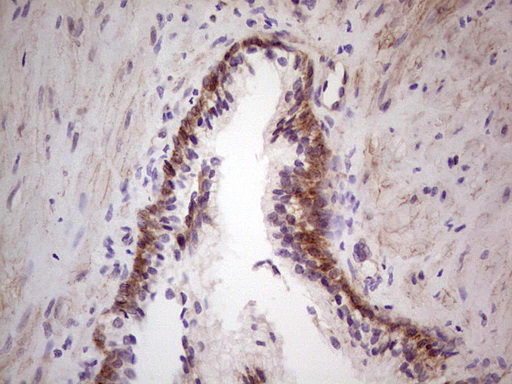 LAMA4 / Laminin Alpha 4 Antibody - Immunohistochemical staining of paraffin-embedded Human prostate tissue within the normal limits using anti-LAMA4 mouse monoclonal antibody.  heat-induced epitope retrieval by 1 mM EDTA in 10mM Tris, pH8.5, 120C for 3min)