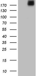 LAMA4 / Laminin Alpha 4 Antibody - HEK293T cells were transfected with the pCMV6-ENTRY control (Left lane) or pCMV6-ENTRY LAMA4 (Right lane) cDNA for 48 hrs and lysed. Equivalent amounts of cell lysates (5 ug per lane) were separated by SDS-PAGE and immunoblotted with anti-LAMA4.