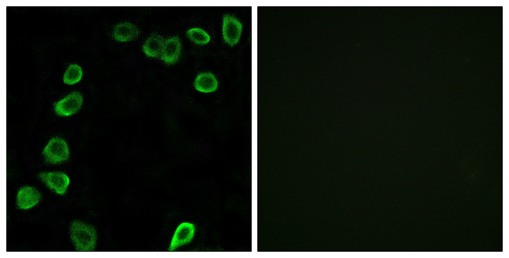 LAMA4 / Laminin Alpha 4 Antibody - Immunofluorescence analysis of NIH/3T3 cells, using LAMA4 Antibody. The picture on the right is blocked with the synthesized peptide.