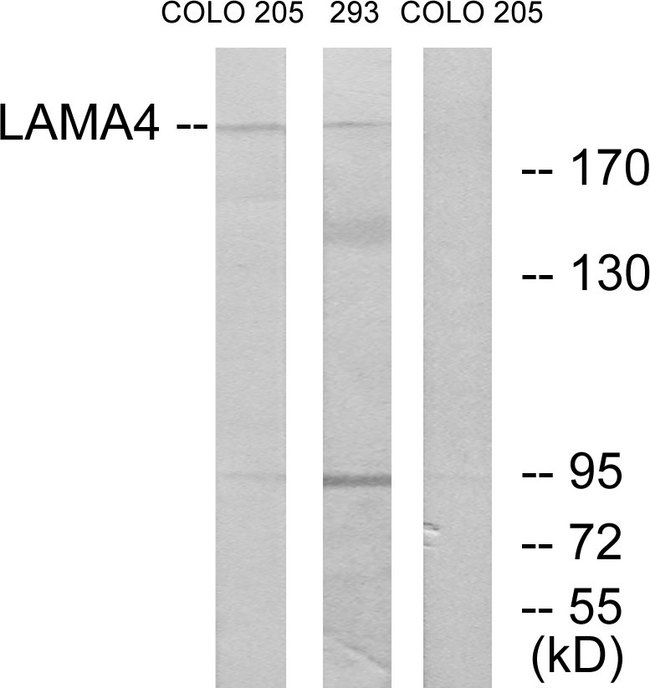 LAMA4 / Laminin Alpha 4 Antibody - Western blot analysis of lysates from COLO and 293 cells, using LAMA4 Antibody. The lane on the right is blocked with the synthesized peptide.