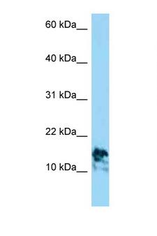 LAMA4 / Laminin Alpha 4 Antibody - LAMA4 antibody Western blot of Jurkat Cell lysate. Antibody concentration 1 ug/ml.  This image was taken for the unconjugated form of this product. Other forms have not been tested.