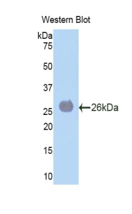 LAMA4 / Laminin Alpha 4 Antibody - Western blot of recombinant LAMA4 / Laminin Alpha 4.  This image was taken for the unconjugated form of this product. Other forms have not been tested.