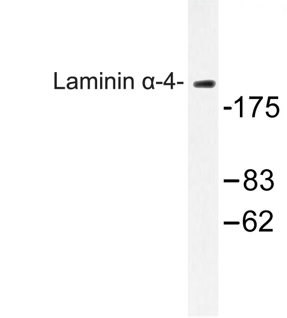 LAMA4 / Laminin Alpha 4 Antibody - Western blot of Laminin -4 (A511) pAb in extracts from COLO cells.