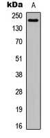 LAMA4 / Laminin Alpha 4 Antibody - Western blot analysis of Laminin alpha 4 expression in HeLa (A) whole cell lysates.