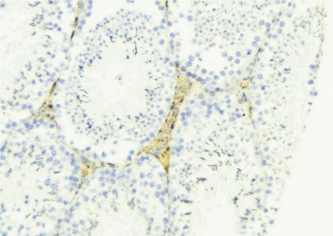 LAMA4 / Laminin Alpha 4 Antibody - 1:100 staining mouse testis tissue by IHC-P. The sample was formaldehyde fixed and a heat mediated antigen retrieval step in citrate buffer was performed. The sample was then blocked and incubated with the antibody for 1.5 hours at 22°C. An HRP conjugated goat anti-rabbit antibody was used as the secondary.