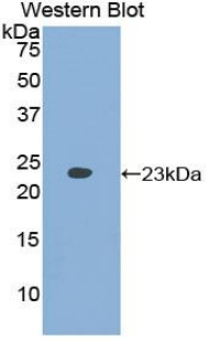 LAMA5 / Laminin Alpha 5 Antibody - Western blot of recombinant LAMA5 / Laminin Alpha 5.  This image was taken for the unconjugated form of this product. Other forms have not been tested.