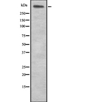 LAMA5 / Laminin Alpha 5 Antibody - Western blot analysis of LAMA5 expression in HEK293 cells. The lane on the left is treated with the antigen-specific peptide.