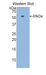 LAMB1 / Laminin Beta 1 Antibody - Western blot of recombinant LAMB1 / Laminin Beta 1.  This image was taken for the unconjugated form of this product. Other forms have not been tested.