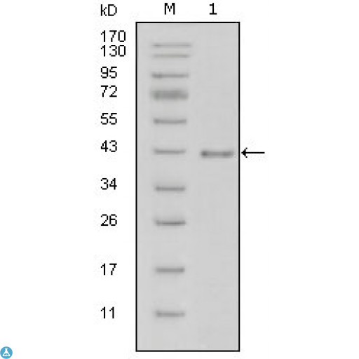 LAMB1 / Laminin Beta 1 Antibody - Western Blot (WB) analysis using Laminin beta-1 Monoclonal Antibody against truncated Laminin beta-1-His recombinant protein (1).