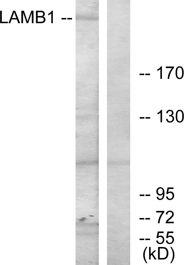 LAMB1 / Laminin Beta 1 Antibody - Western blot analysis of extracts from HepG2 cells, using LAMB1 antibody.