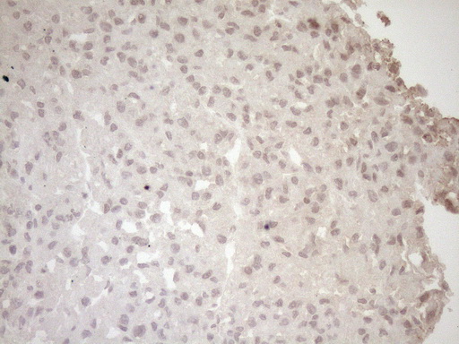 LAMB2 / Laminin Beta 2 Antibody - Immunohistochemical staining of paraffin-embedded Human liver tissue within the normal limits using anti-LAMB2 mouse monoclonal antibody. (Heat-induced epitope retrieval by 1mM EDTA in 10mM Tris buffer. (pH8.5) at 120°C for 3 min. (1:150)