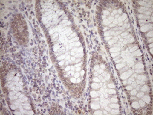 LAMB2 / Laminin Beta 2 Antibody - Immunohistochemical staining of paraffin-embedded Human colon tissue within the normal limits using anti-LAMB2 mouse monoclonal antibody. (Heat-induced epitope retrieval by 1mM EDTA in 10mM Tris buffer. (pH8.5) at 120°C for 3 min. (1:150)