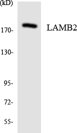 LAMB2 / Laminin Beta 2 Antibody - Western blot analysis of the lysates from HepG2 cells using LAMB2 antibody.