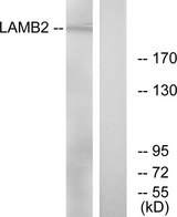 LAMB2 / Laminin Beta 2 Antibody - Western blot analysis of lysates from RAW264.7 cells, using LAMB2 Antibody. The lane on the right is blocked with the synthesized peptide.