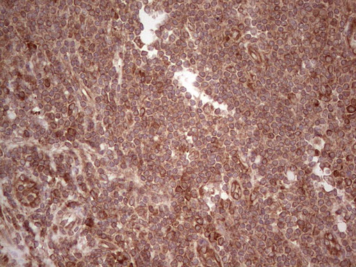 LAMB3 / Laminin Beta 3 Antibody - Immunohistochemical staining of paraffin-embedded Human tonsil within the normal limits using anti-LAMB3 mouse monoclonal antibody. (Heat-induced epitope retrieval by 1 mM EDTA in 10mM Tris, pH8.5, 120C for 3min,