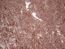 LAMB3 / Laminin Beta 3 Antibody - Immunohistochemical staining of paraffin-embedded Human tonsil within the normal limits using anti-LAMB3 mouse monoclonal antibody. (Heat-induced epitope retrieval by 1 mM EDTA in 10mM Tris, pH8.5, 120C for 3min,