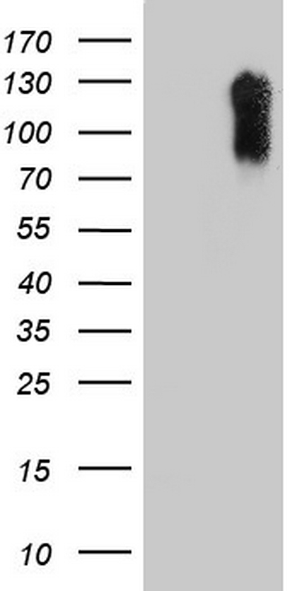 LAMB3 / Laminin Beta 3 Antibody - HEK293T cells were transfected with the pCMV6-ENTRY control (Left lane) or pCMV6-ENTRY LAMB3 (Right lane) cDNA for 48 hrs and lysed. Equivalent amounts of cell lysates (5 ug per lane) were separated by SDS-PAGE and immunoblotted with anti-LAMB3.